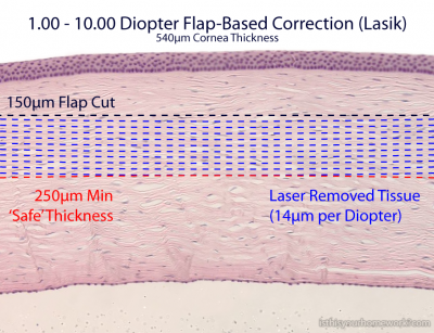 Flap-Based Correction