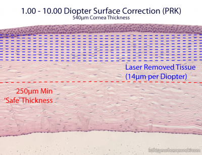 Surface Correction